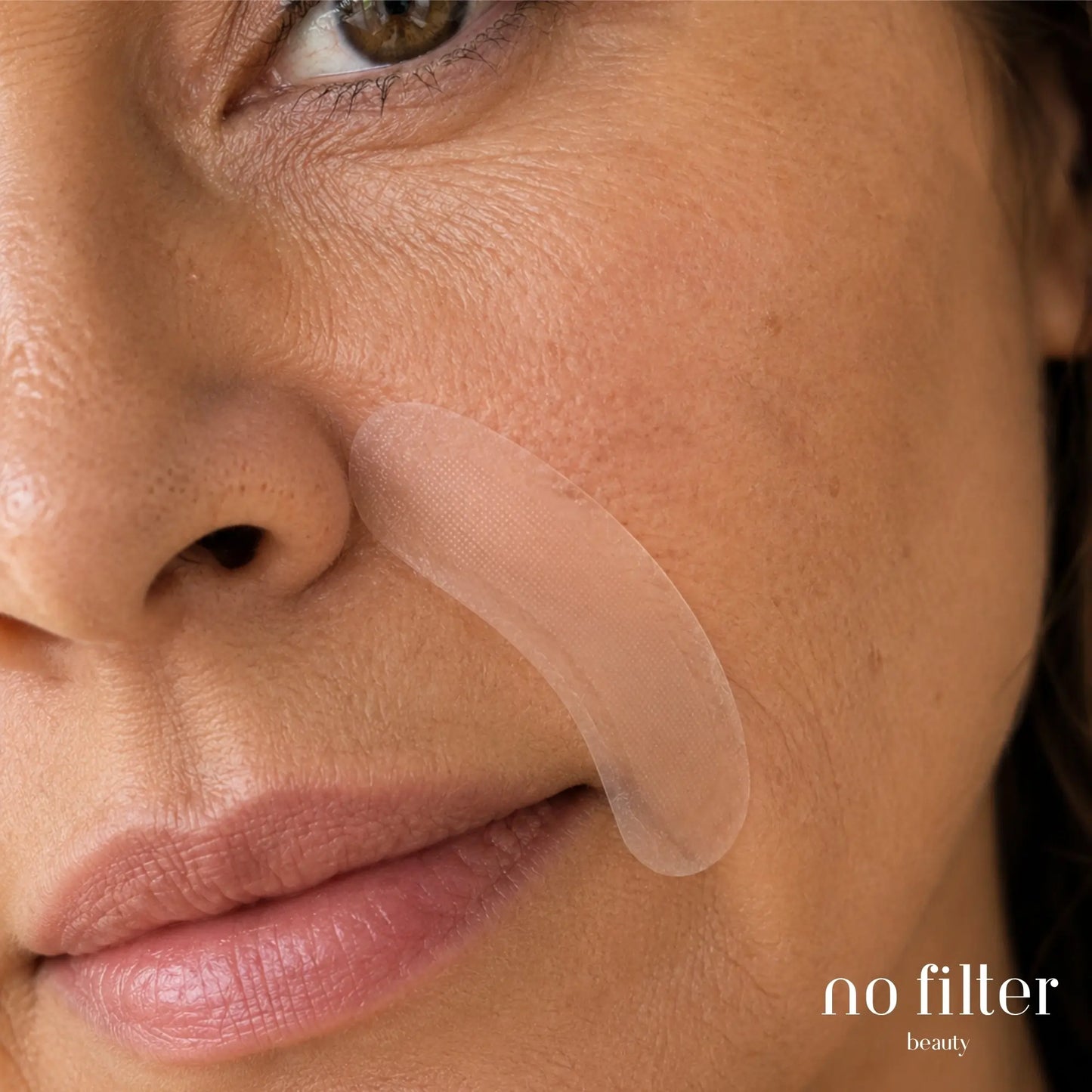 Parches de Microinfusión para Ojos y Surcos Nasogenianos