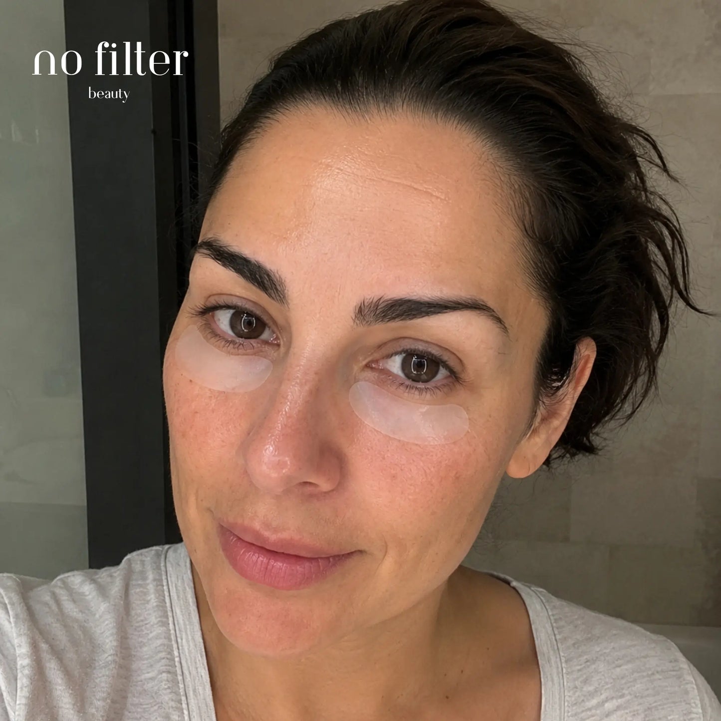 Parches de Microinfusión para Ojos y Surcos Nasogenianos