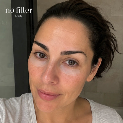 Parches de Microinfusión para Ojos y Surcos Nasogenianos